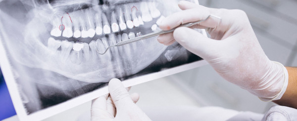 Seleção de Docente Para o Curso de Odontologia da Faculdade CNEC Santo Ângelo.